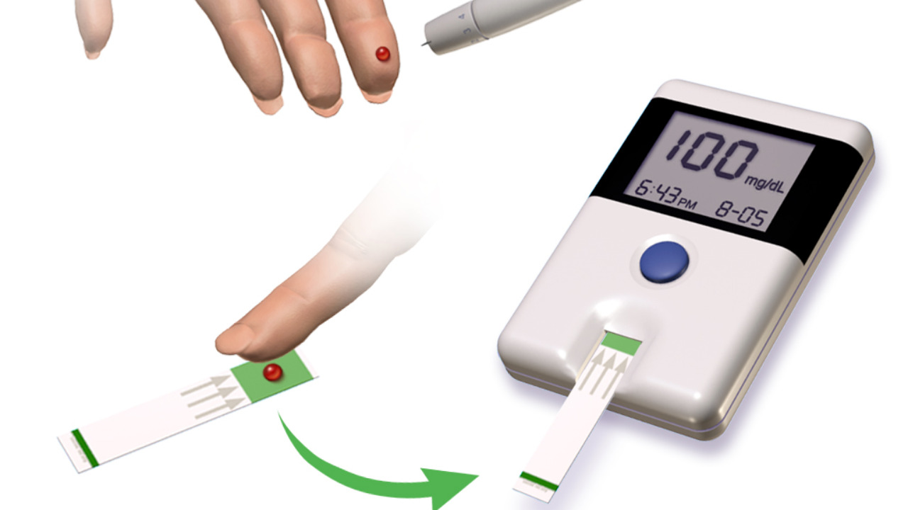 Image Credit: BruceBlaus. When using this image in external sources it can be cited as:
Blausen.com staff (2014). 'Medical gallery of Blausen Medical 2014'. WikiJournal of Medicine 1 (2). DOI:10.15347/wjm/2014.010. ISSN 2002-4436. - CC BY 3.0/Wiki Commons